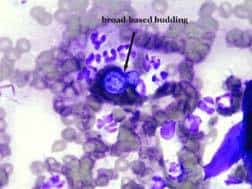 Blastomyces yeast in budding stage