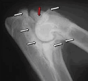 Elbow Joint Abnormalities in dogs
