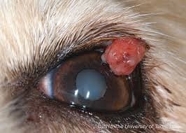 Large eyelid mass requires general anesthesia  and resection of eyelid