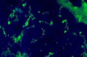 leptospira