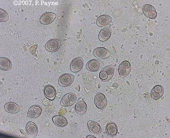 These are infectious Coccidia oocysts 