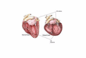 grain-free diets good vs bad heart