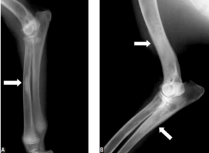 diagnosing Bone Inflammation, Panosteitis